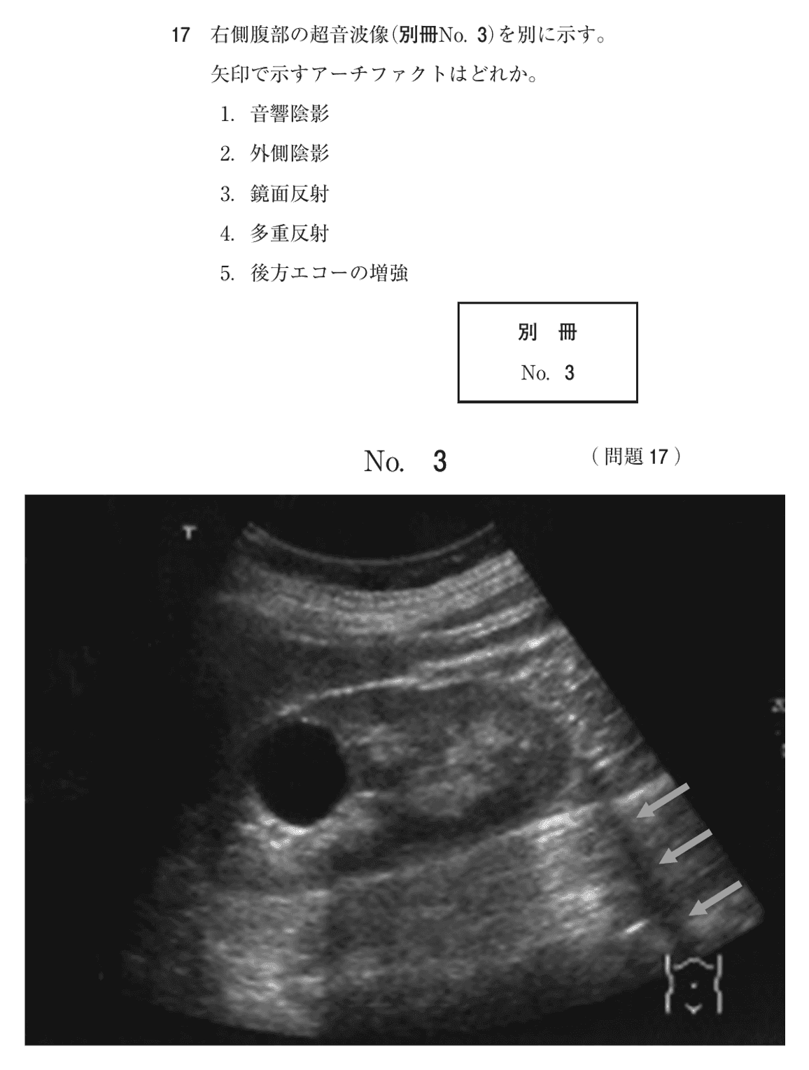 第74回 午前 問17の紙面