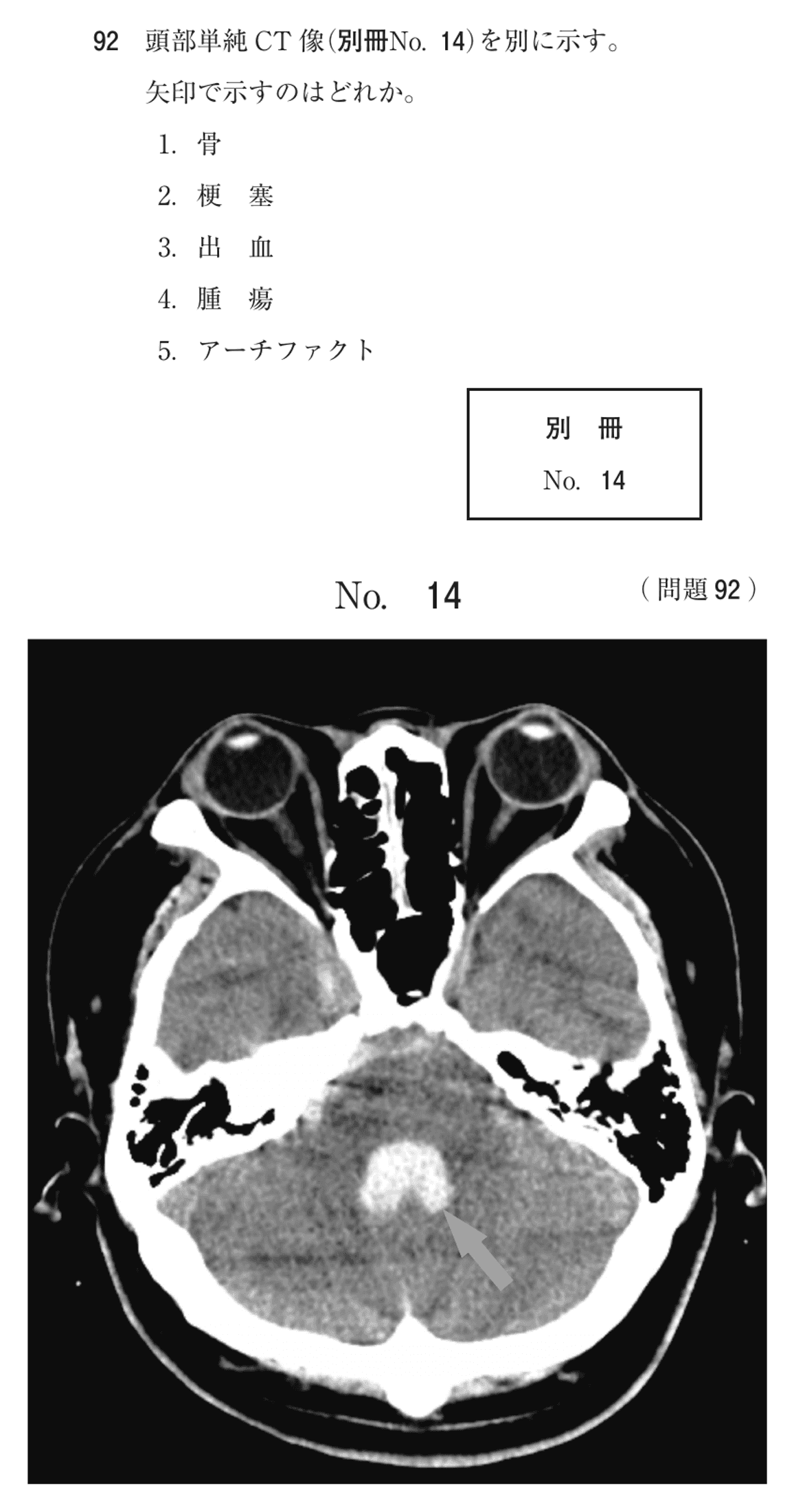 第74回 午前 問92の紙面