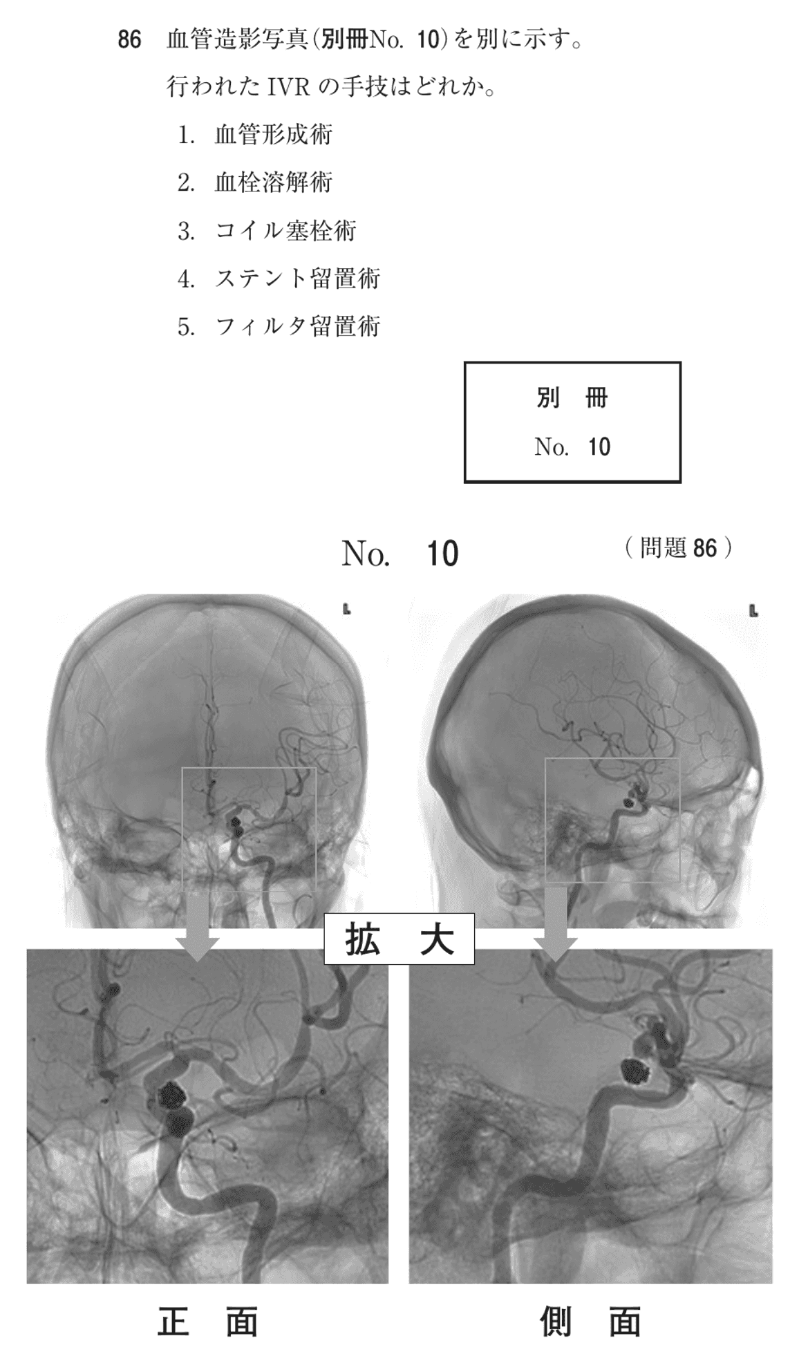 第74回 午後 問86の紙面