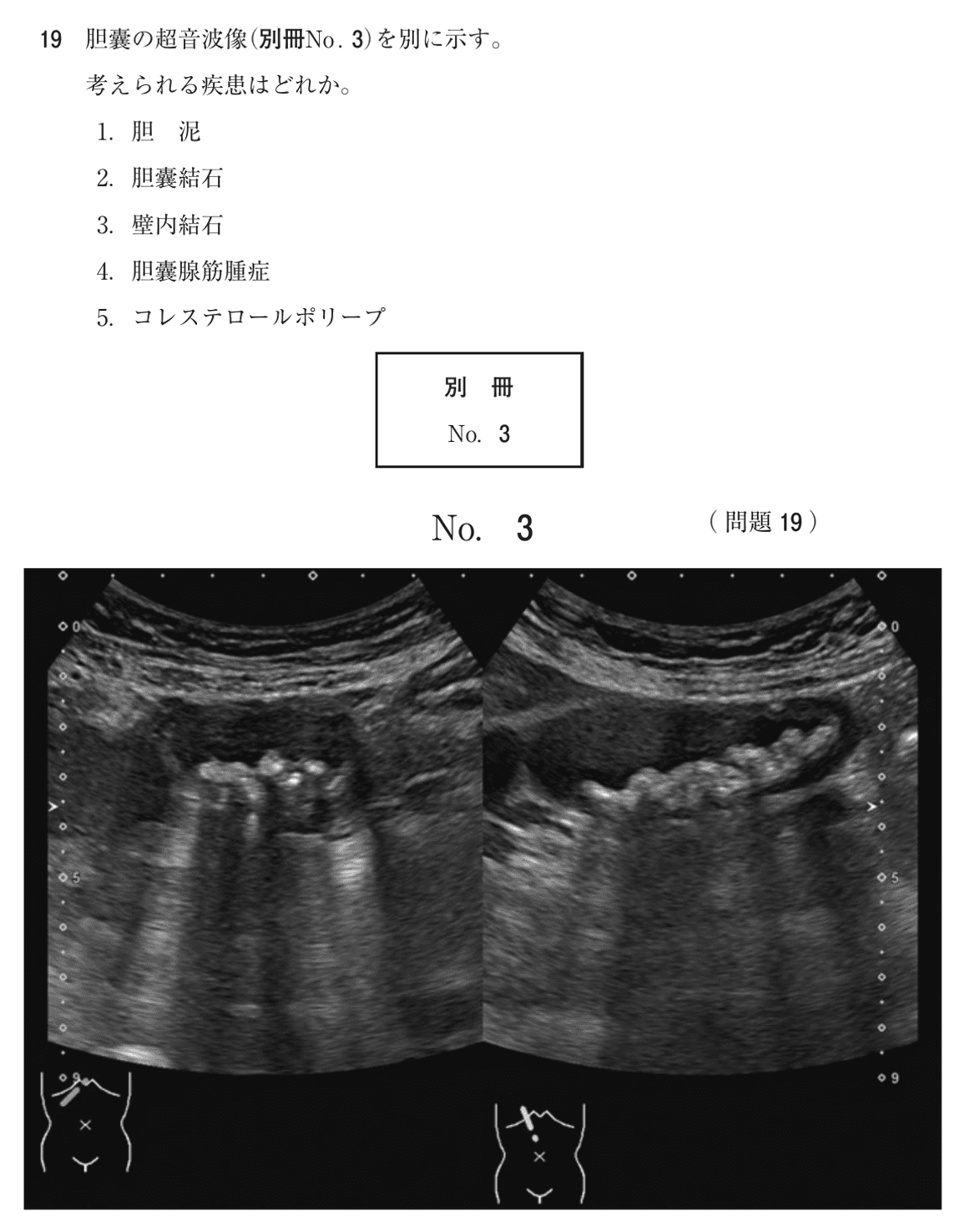 第75回 午前 問19の紙面