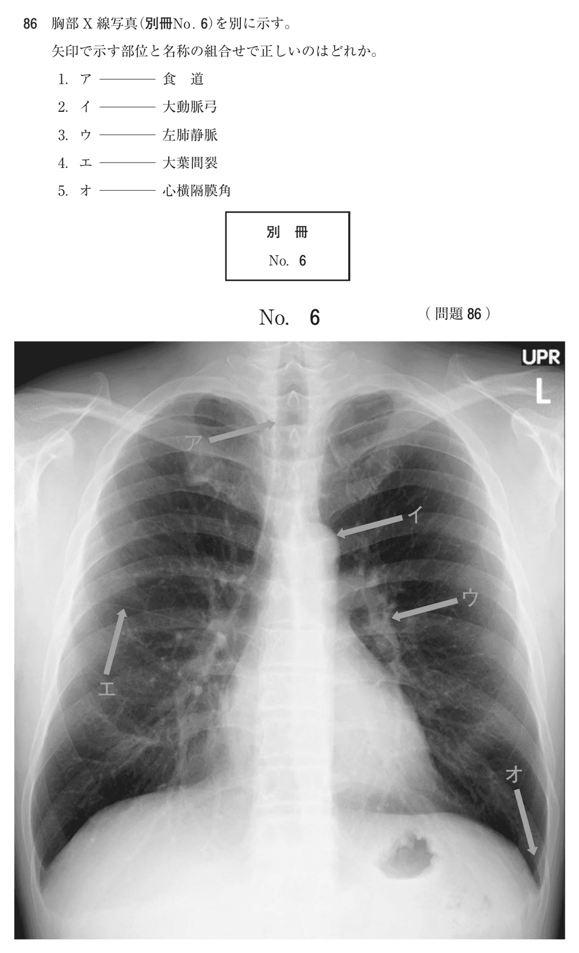 第75回 午前 問86の紙面