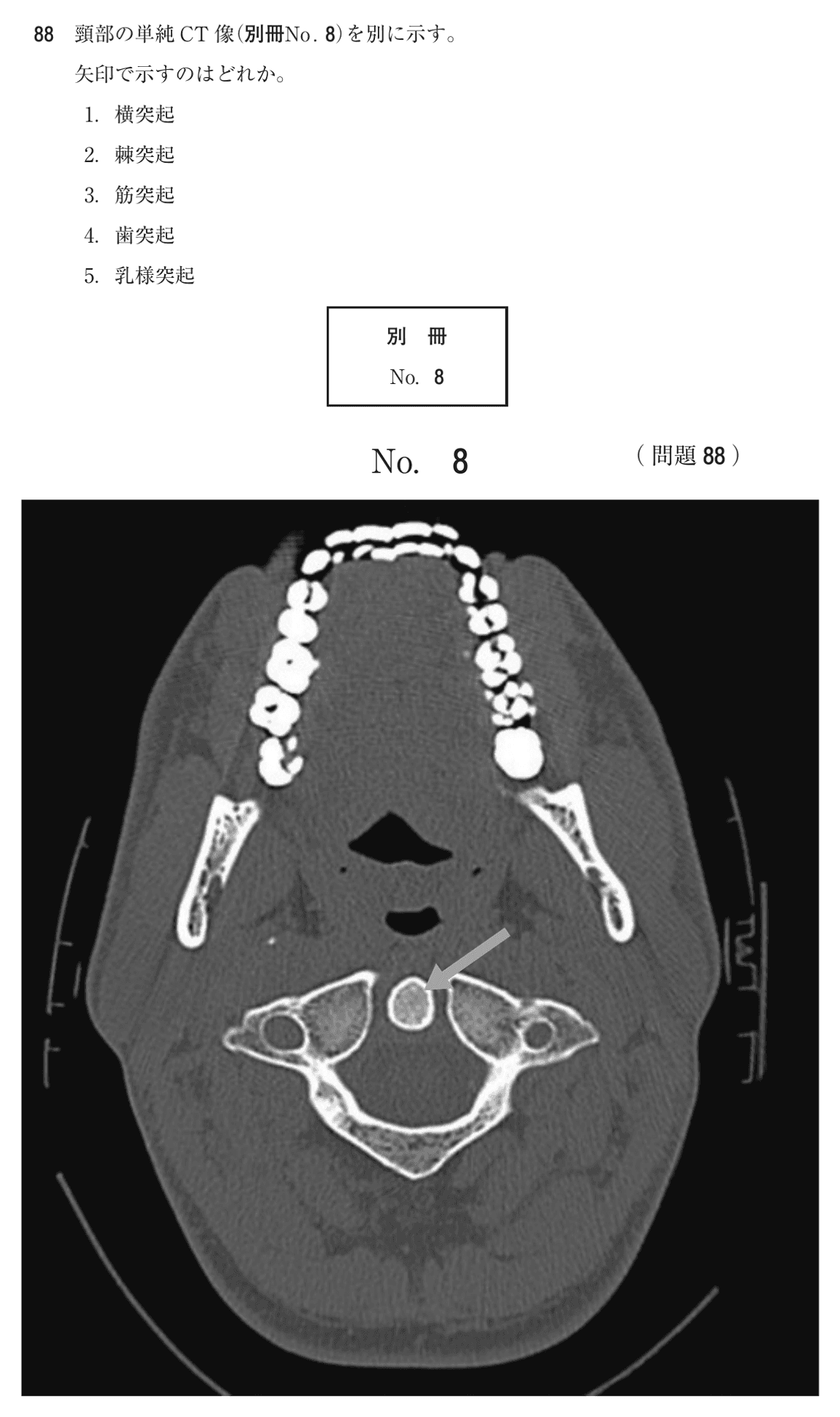 第75回 午前 問88の紙面