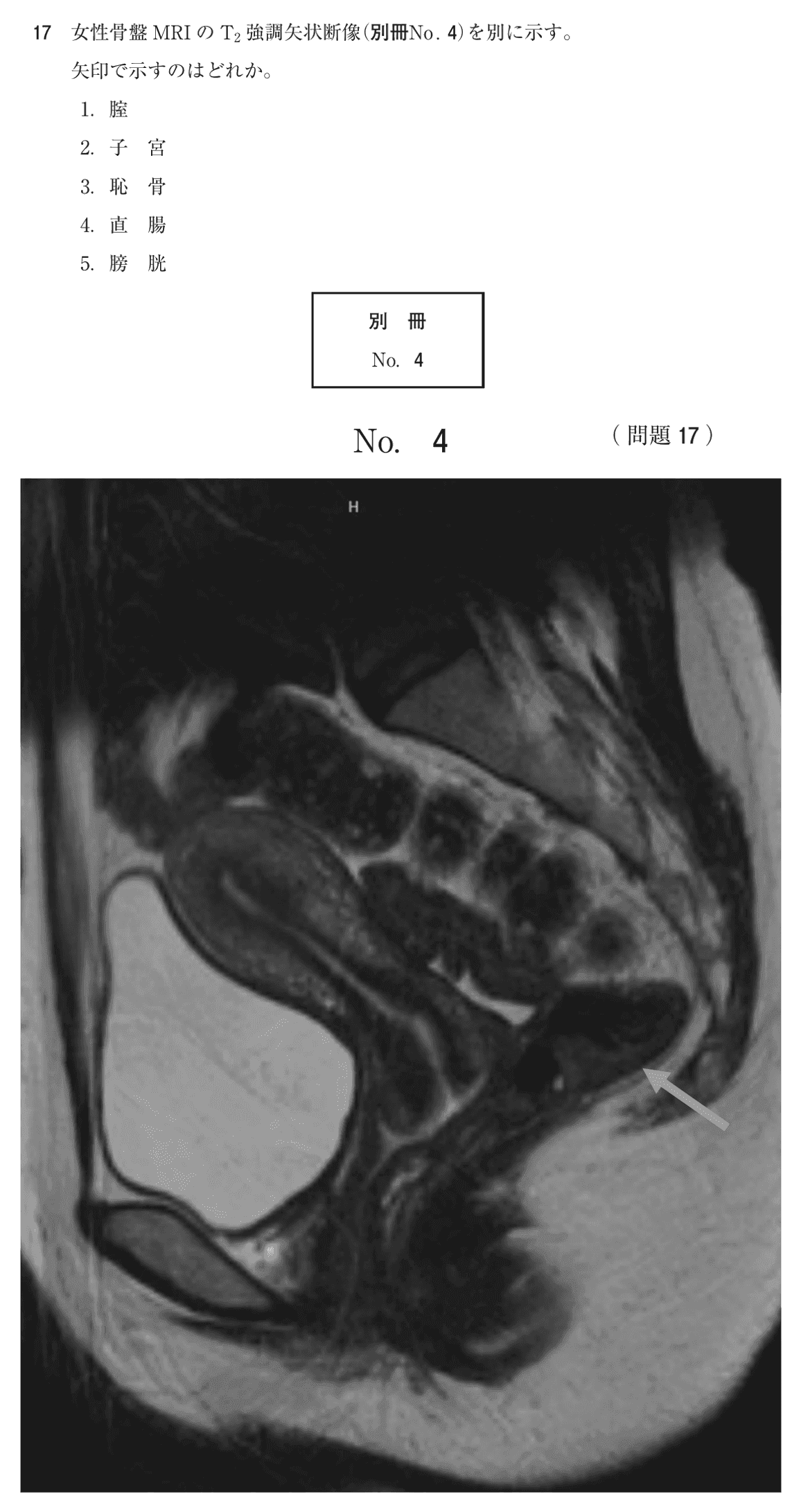 第75回 午後 問17の紙面