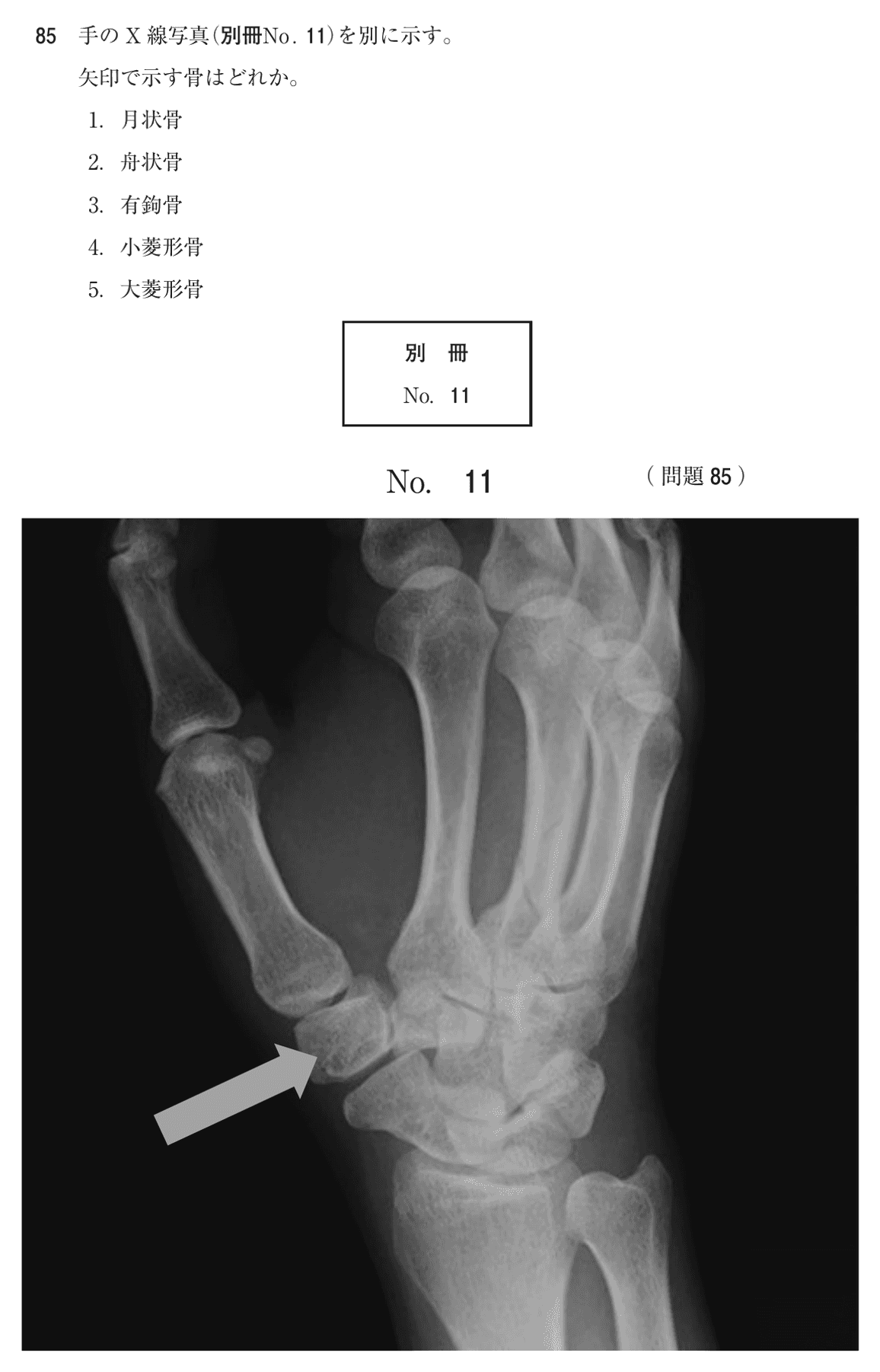 第75回 午後 問85の紙面