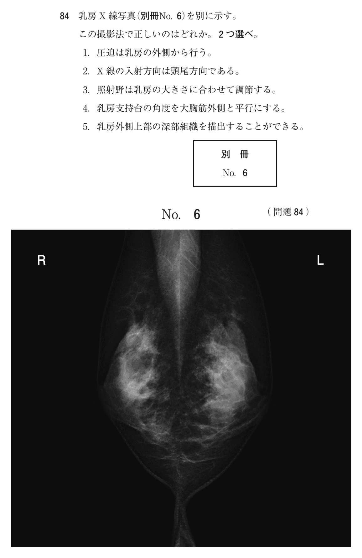 第76回 午前 問84の紙面