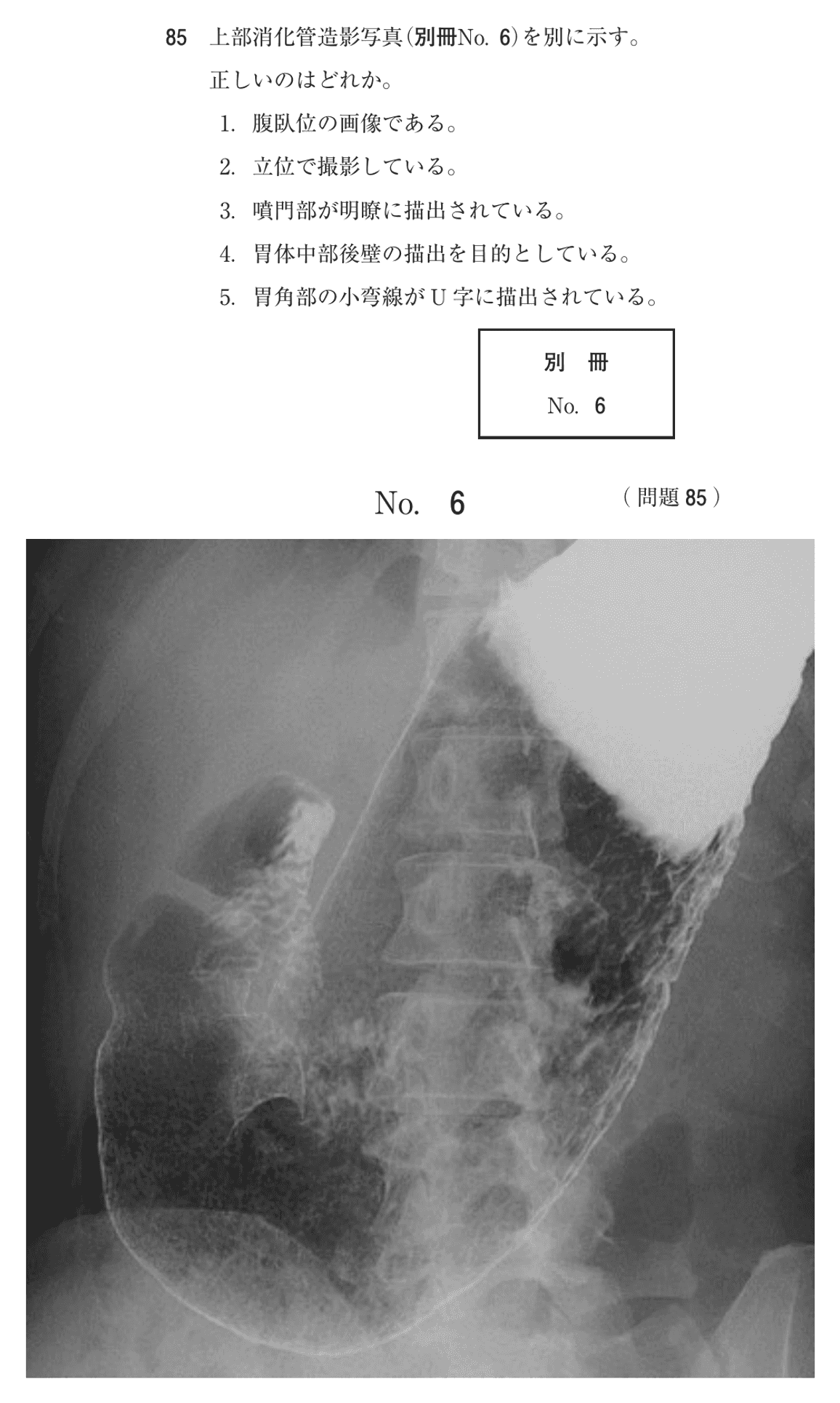第76回 午後 問85の紙面