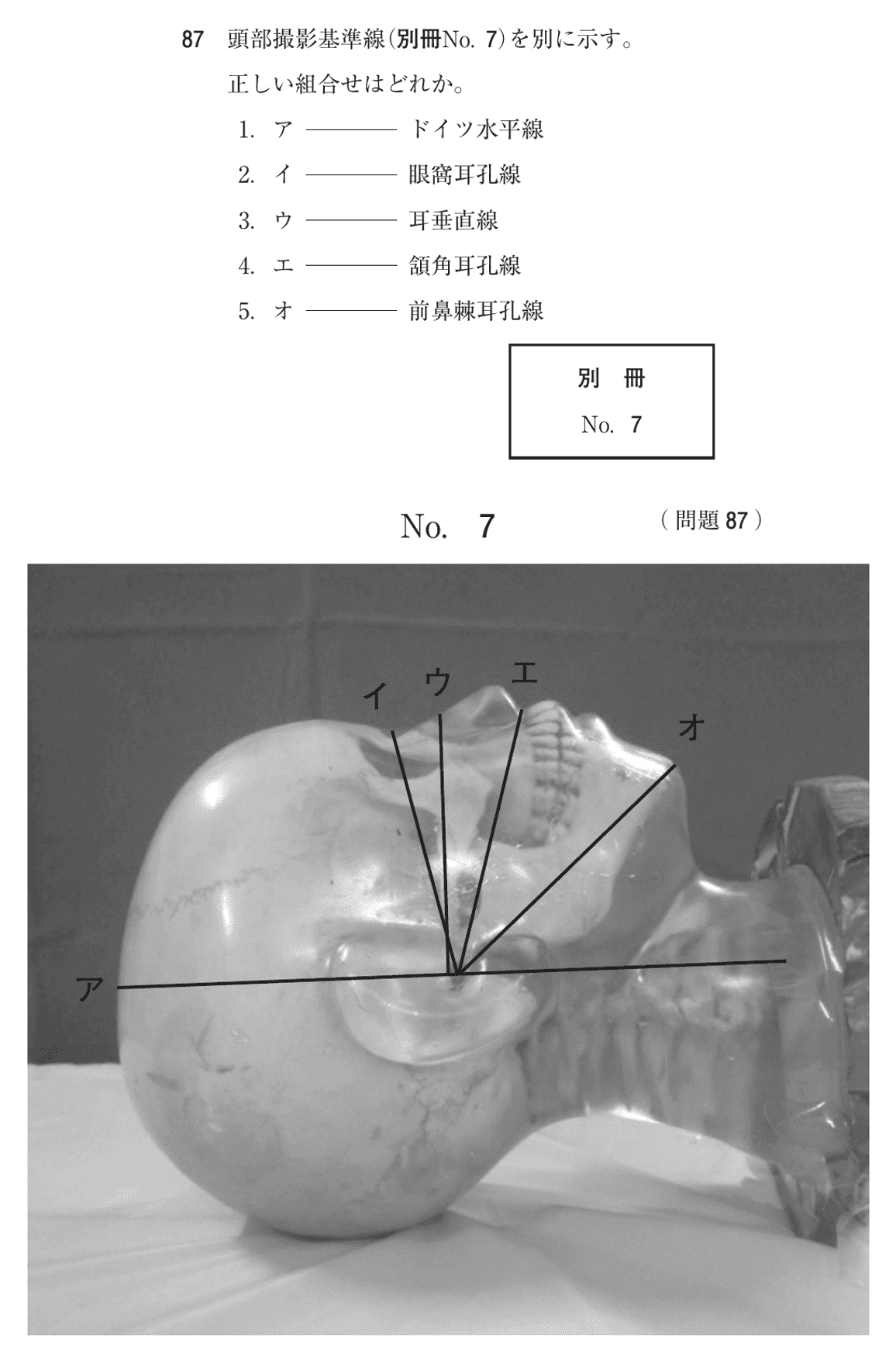 第76回 午後 問87の紙面