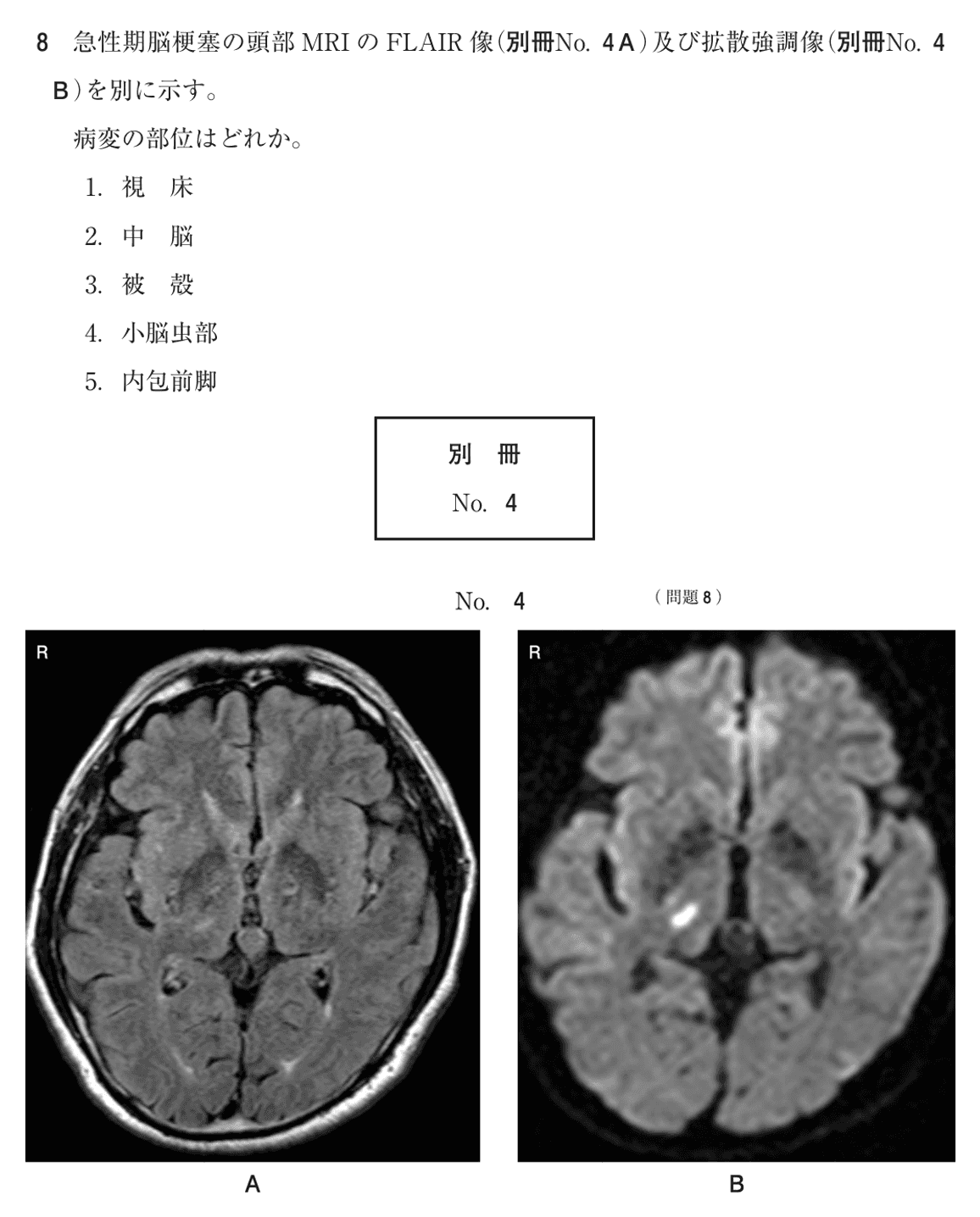 第77回 午前 問8の紙面