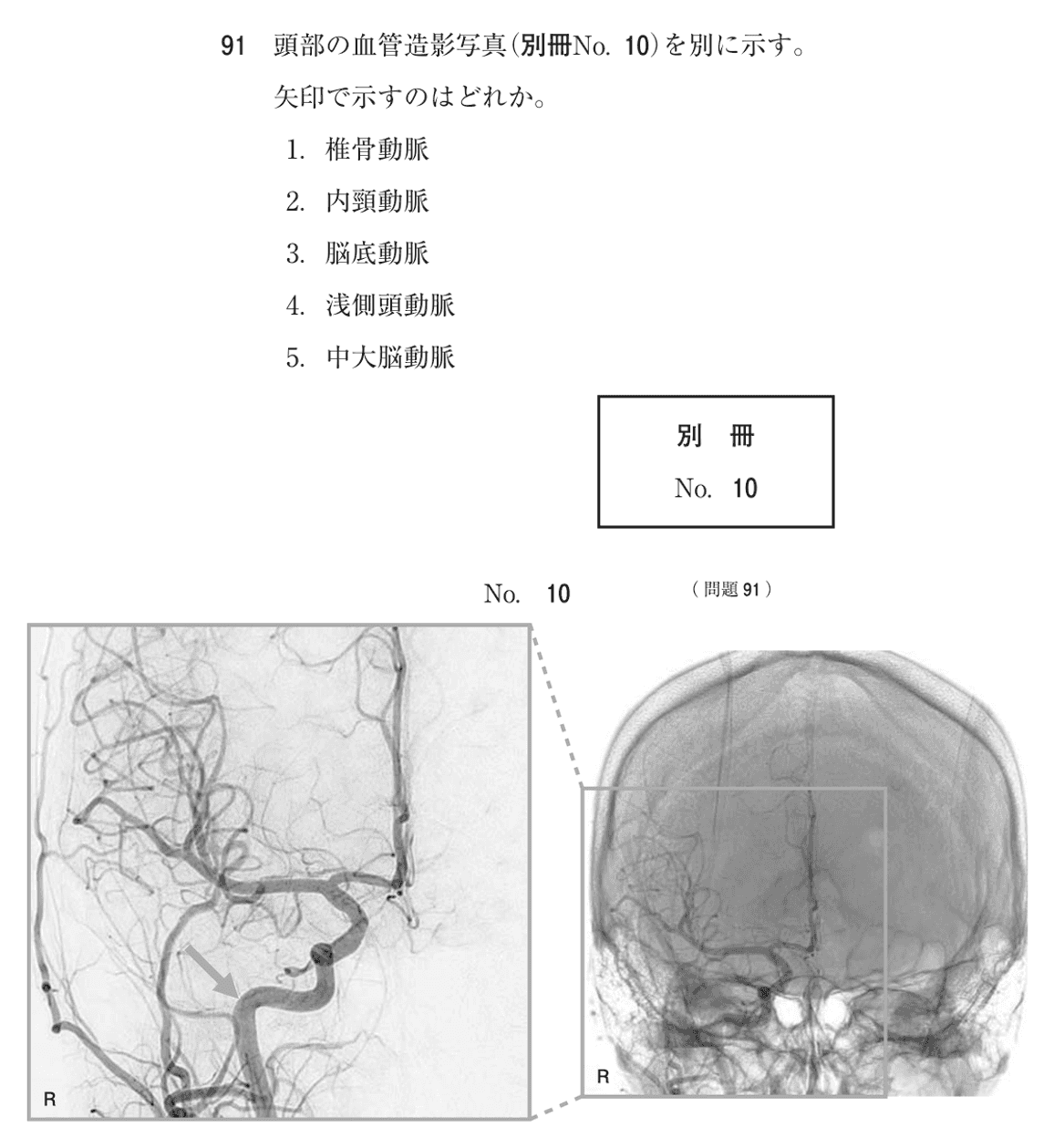 第77回 午前 問91の紙面