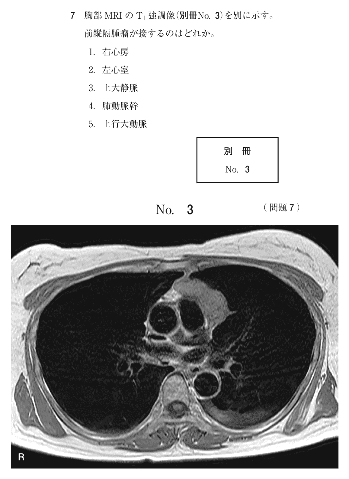 第78回 午前 問7の紙面