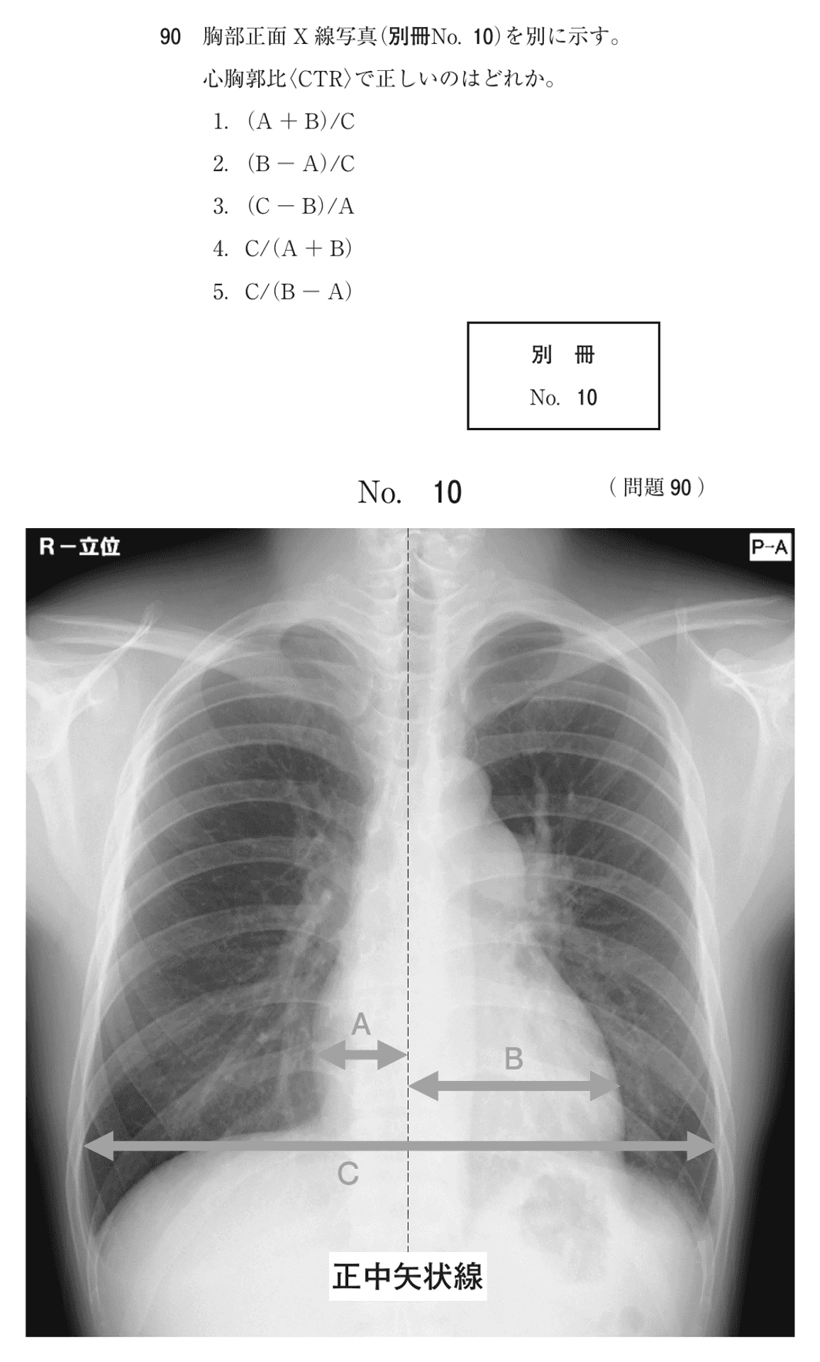 第78回 午前 問90の紙面