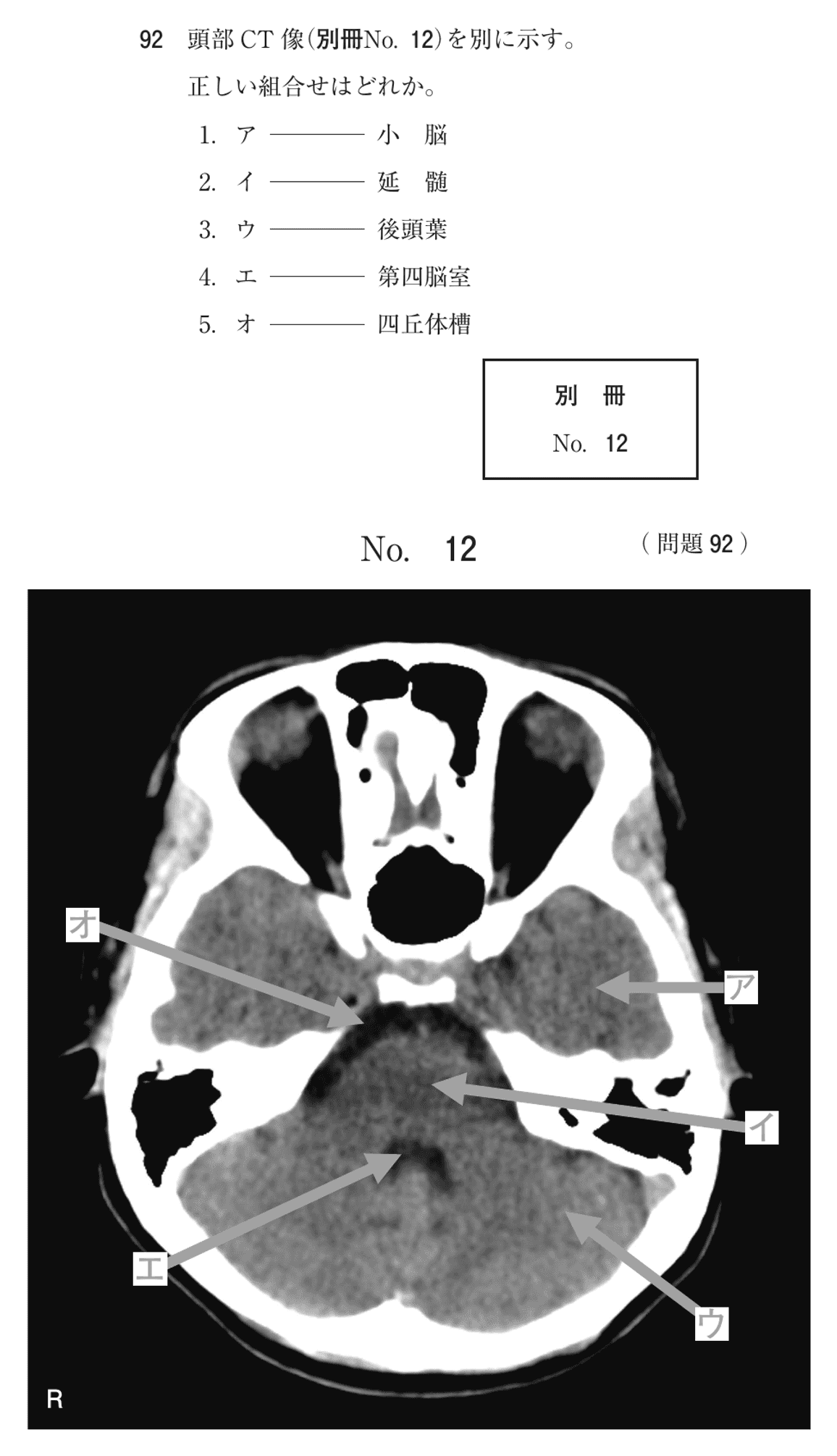 第78回 午前 問92の紙面