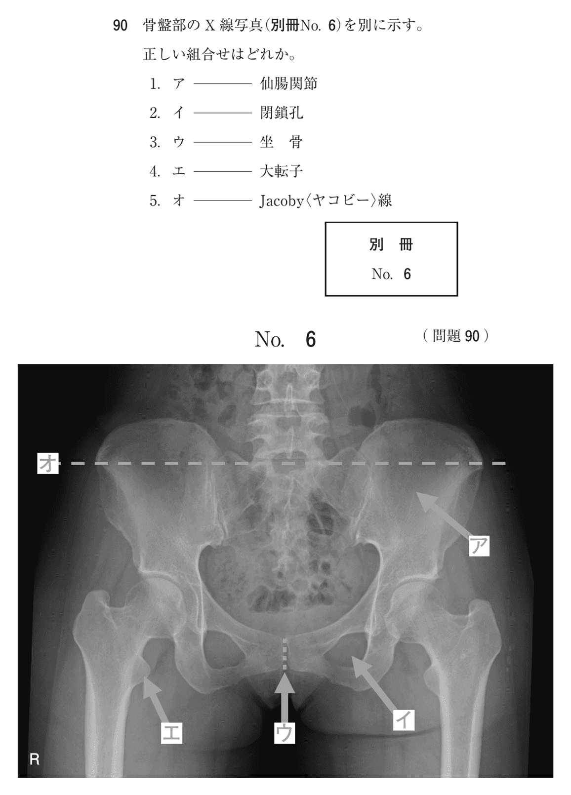 第78回 午後 問90の紙面