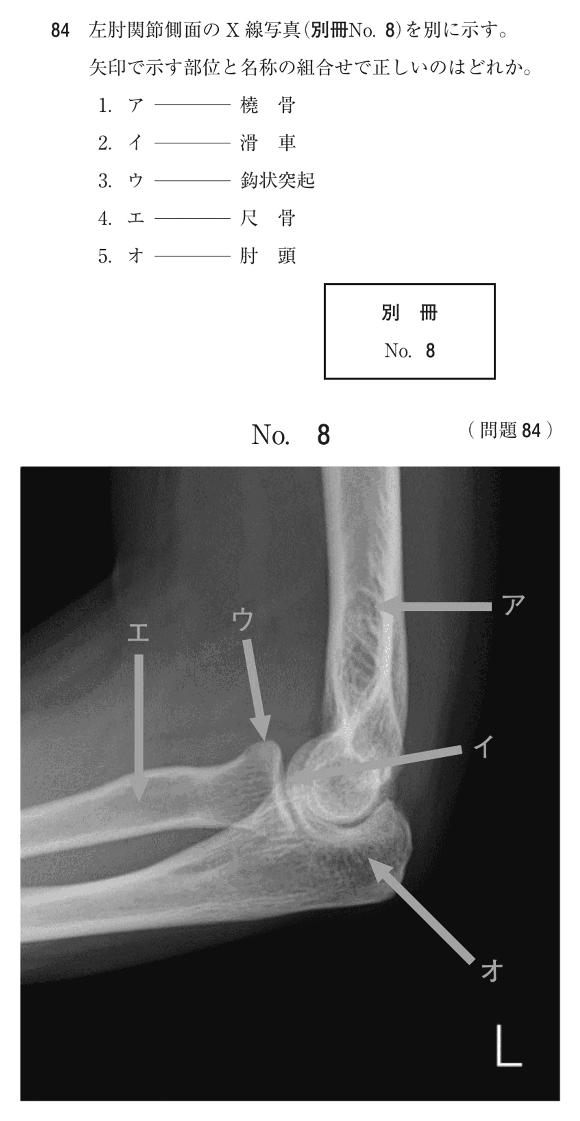 第74回 午前 問84の紙面