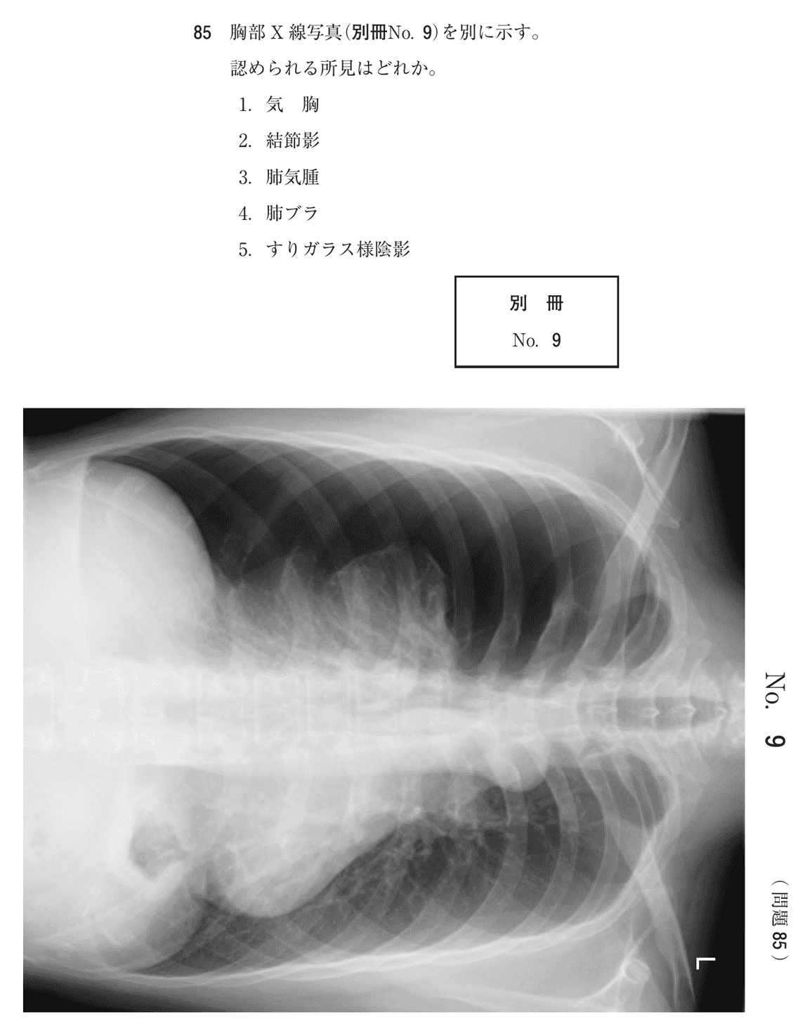 第74回 午前 問85の紙面