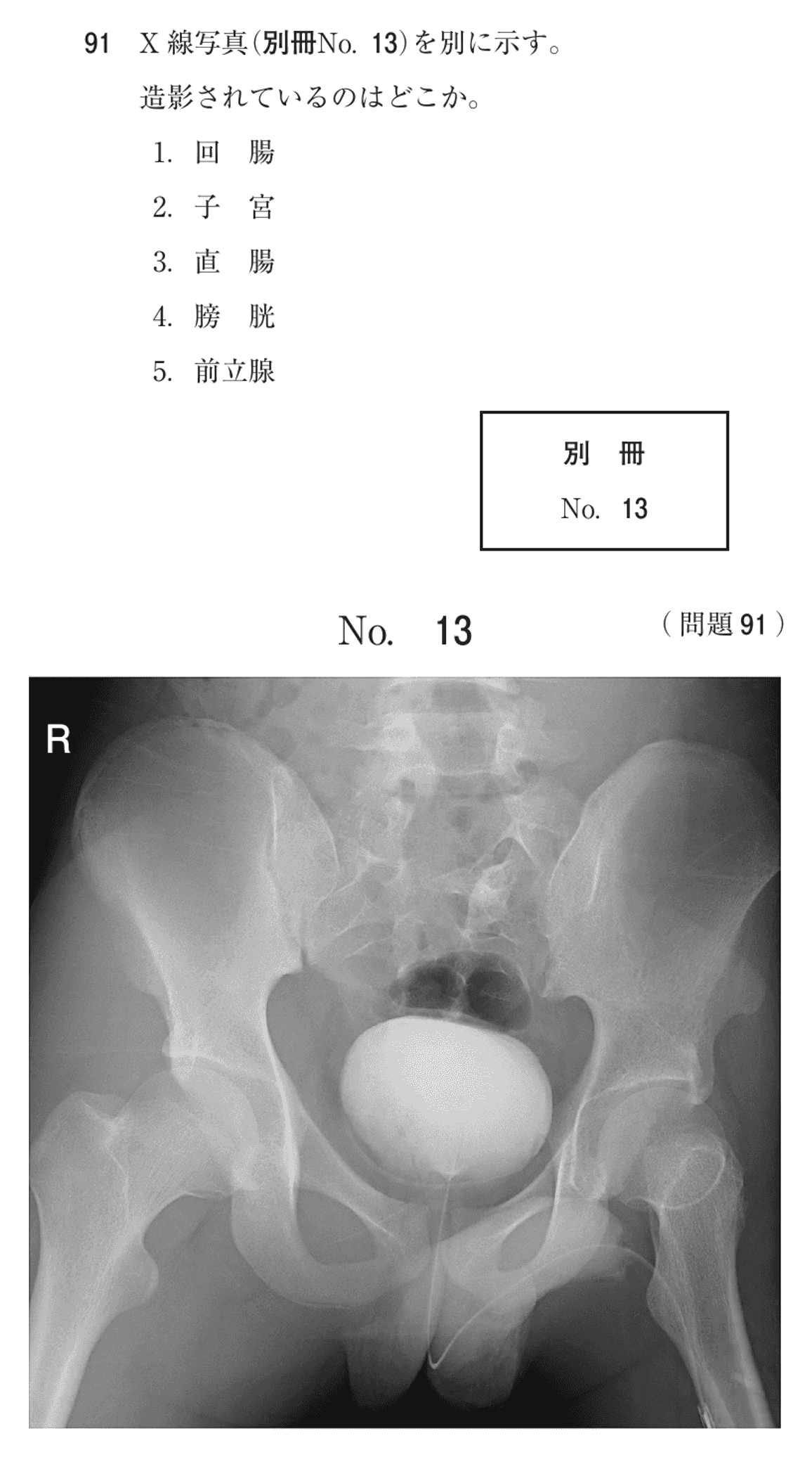 第74回 午前 問91の紙面