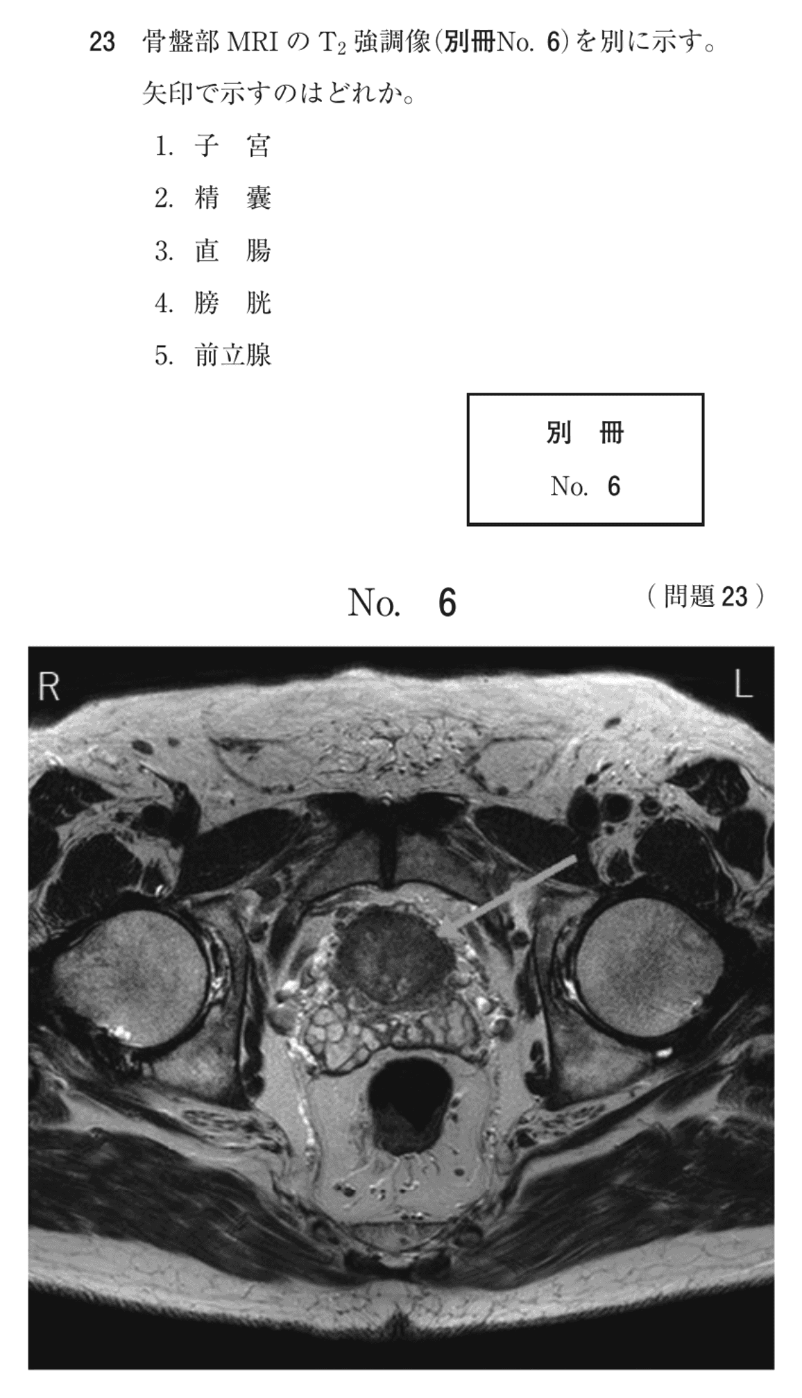 第74回 午後 問23の紙面