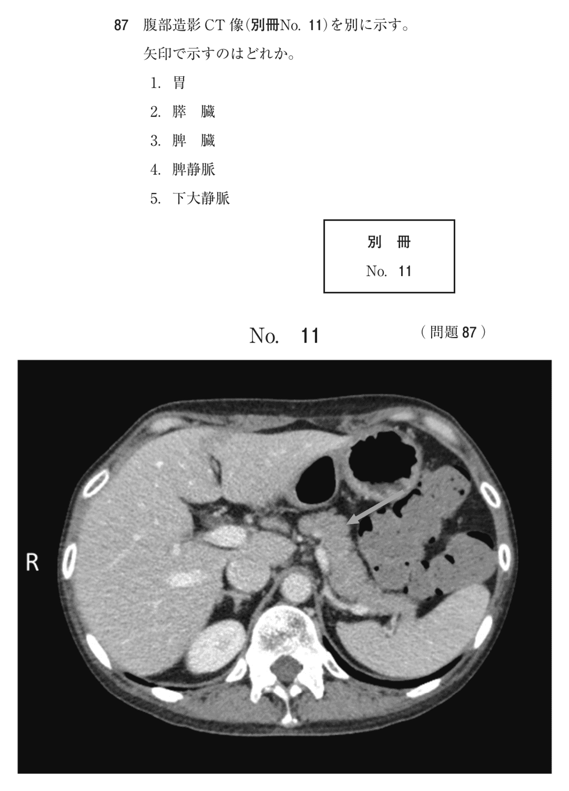第74回 午後 問87の紙面