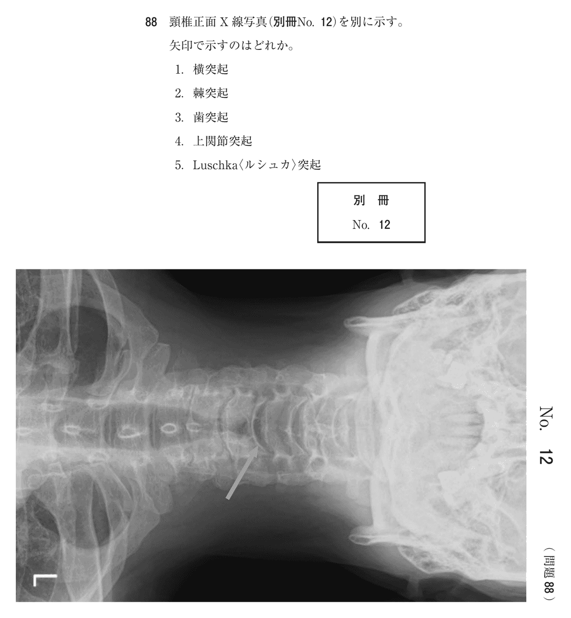 第74回 午後 問88の紙面