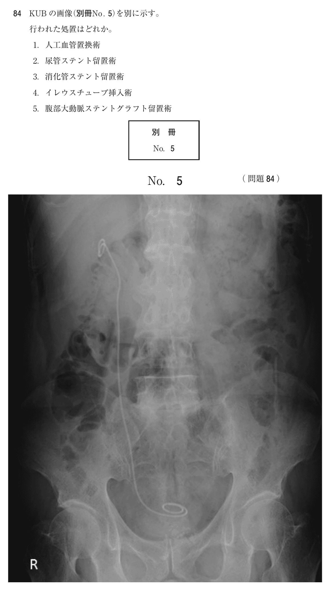 第75回 午前 問84の紙面