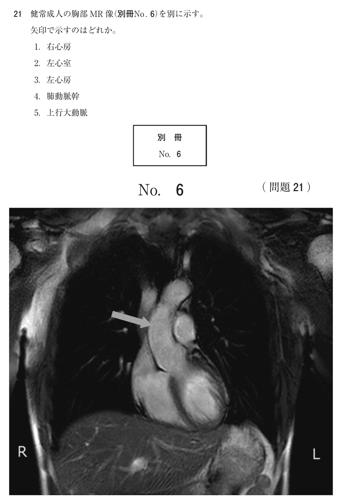 第75回 午後 問21の紙面