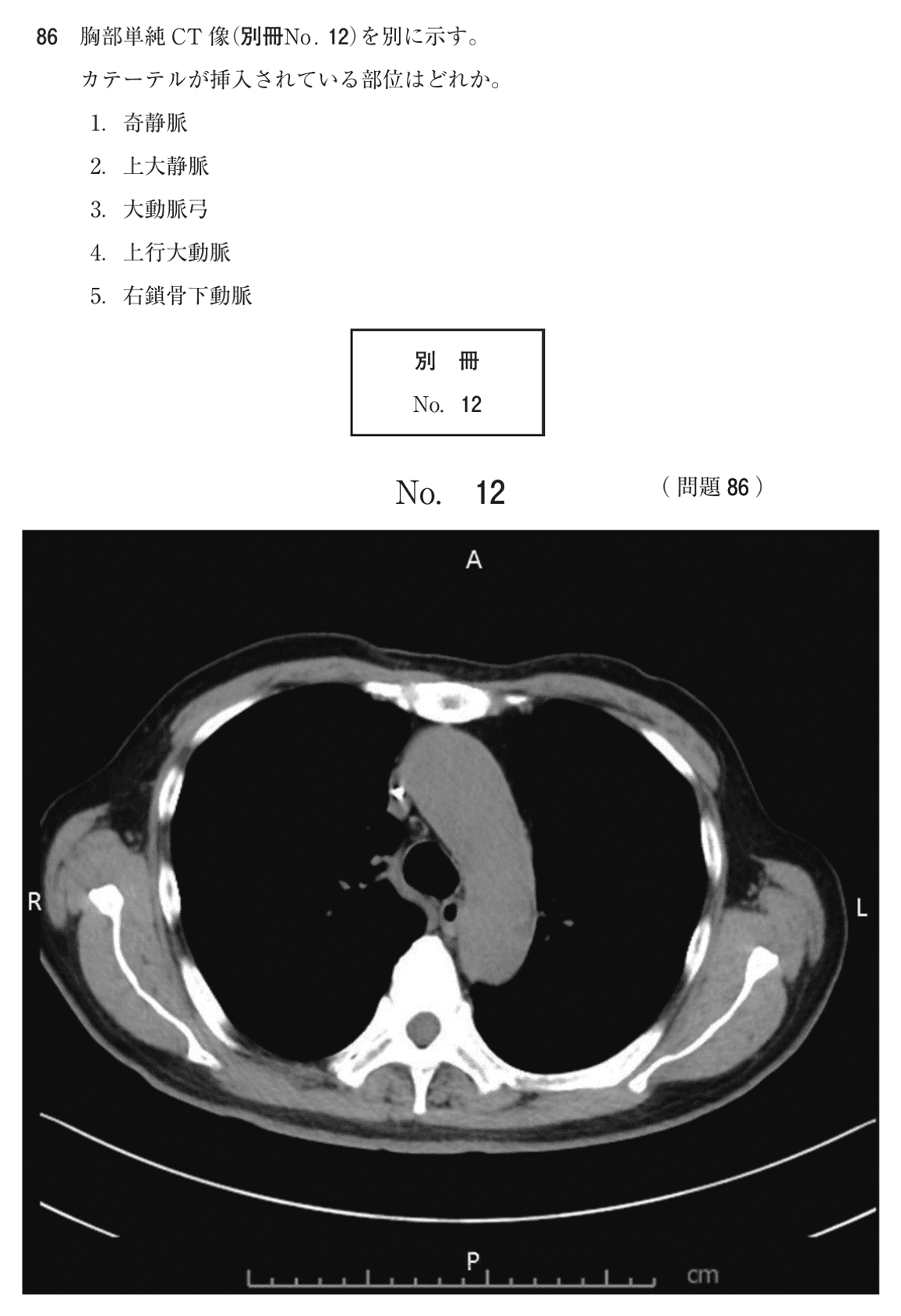 第75回 午後 問86の紙面