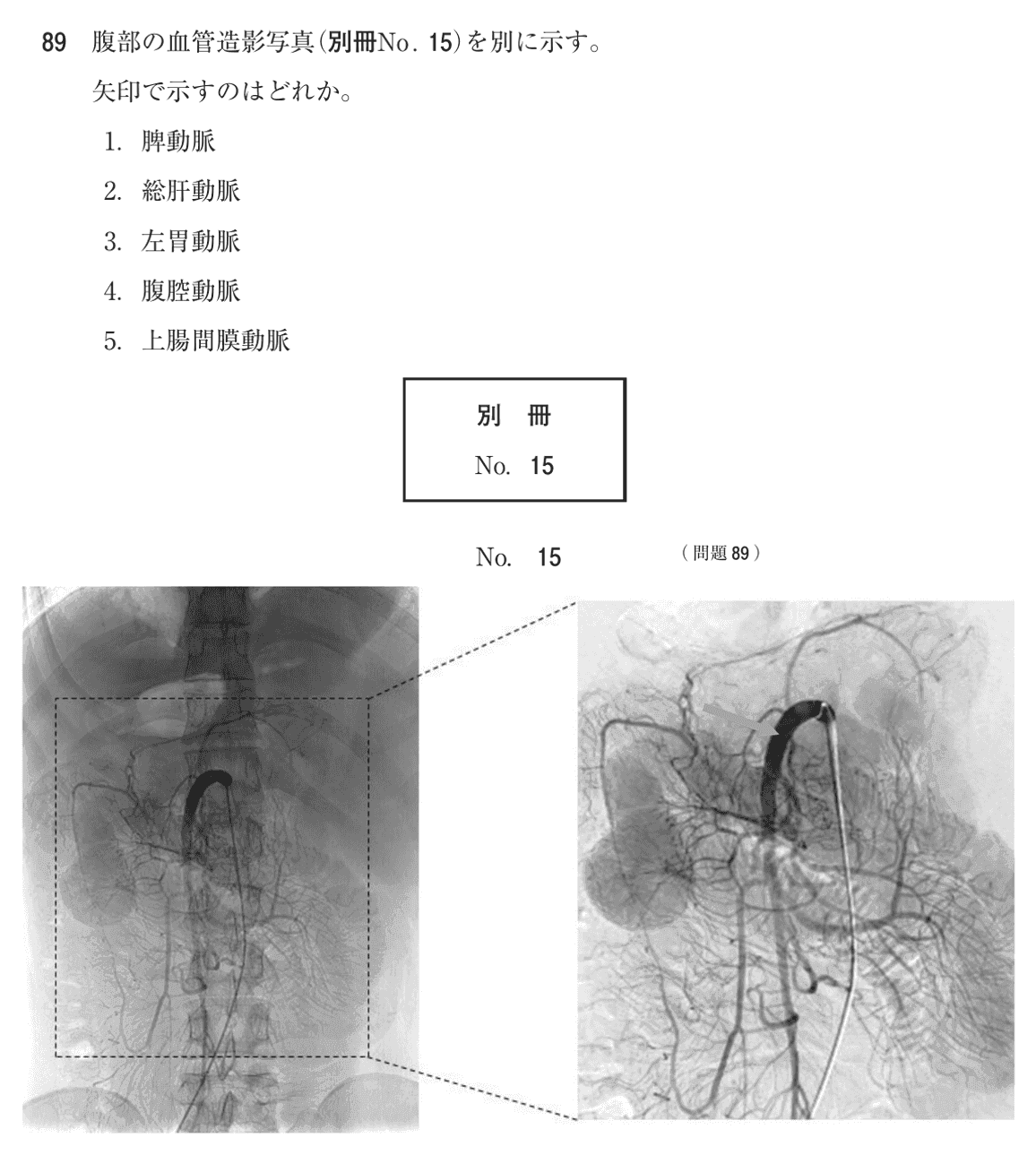第75回 午後 問89の紙面