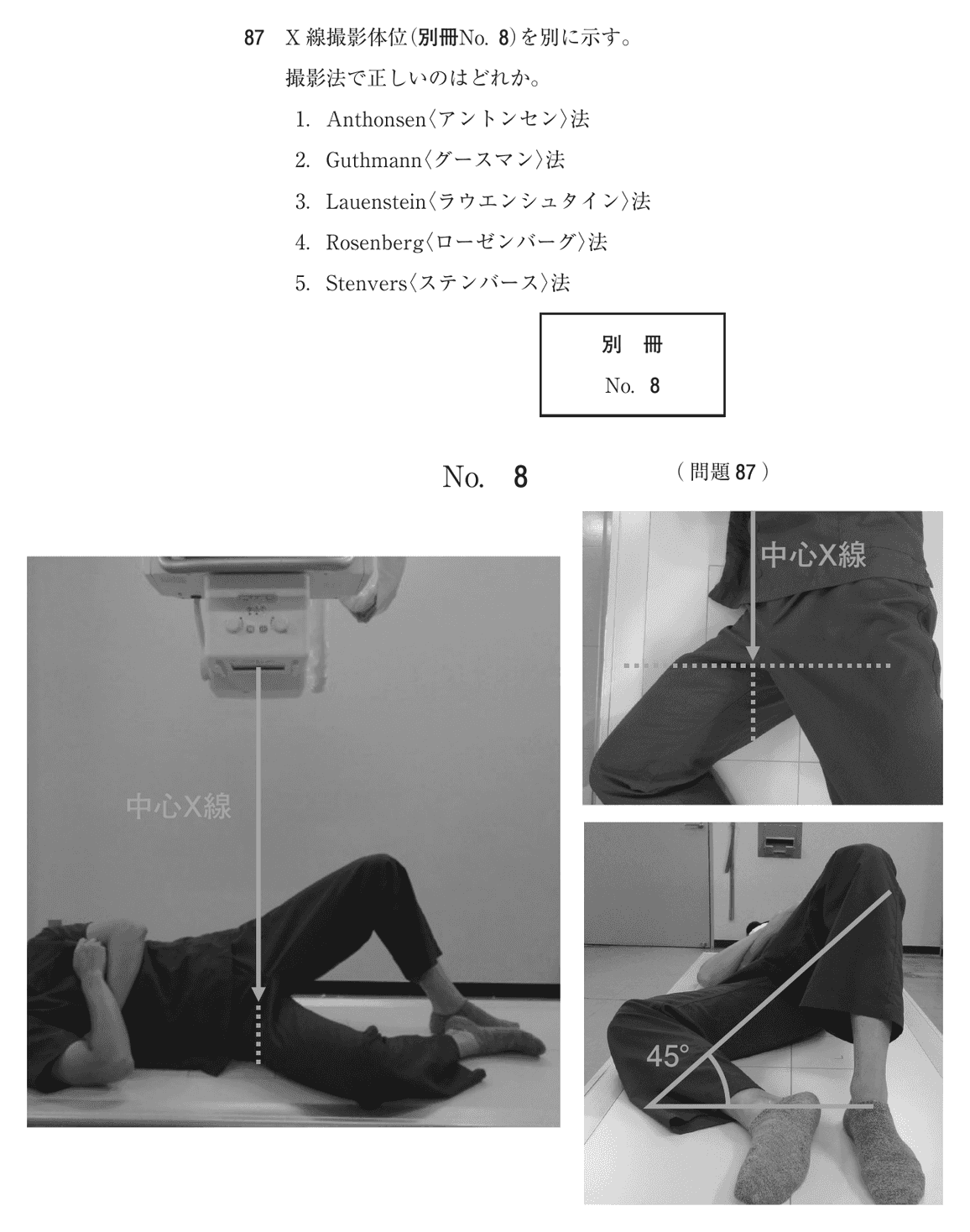 第76回 午前 問87の紙面