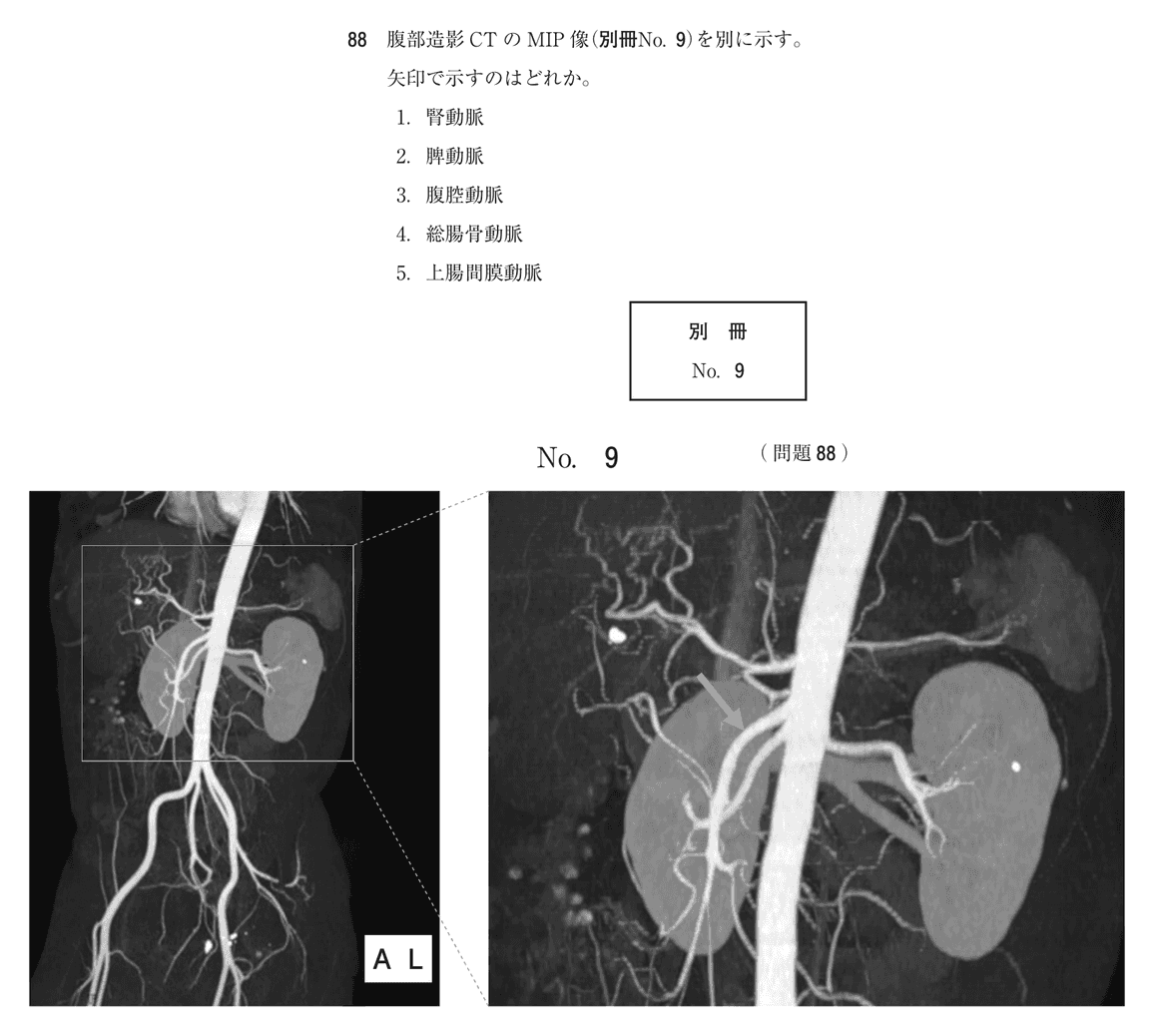 第76回 午前 問88の紙面