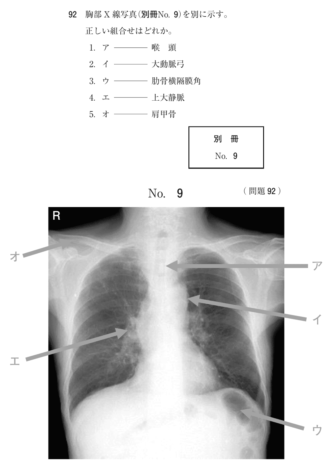 第76回 午後 問92の紙面