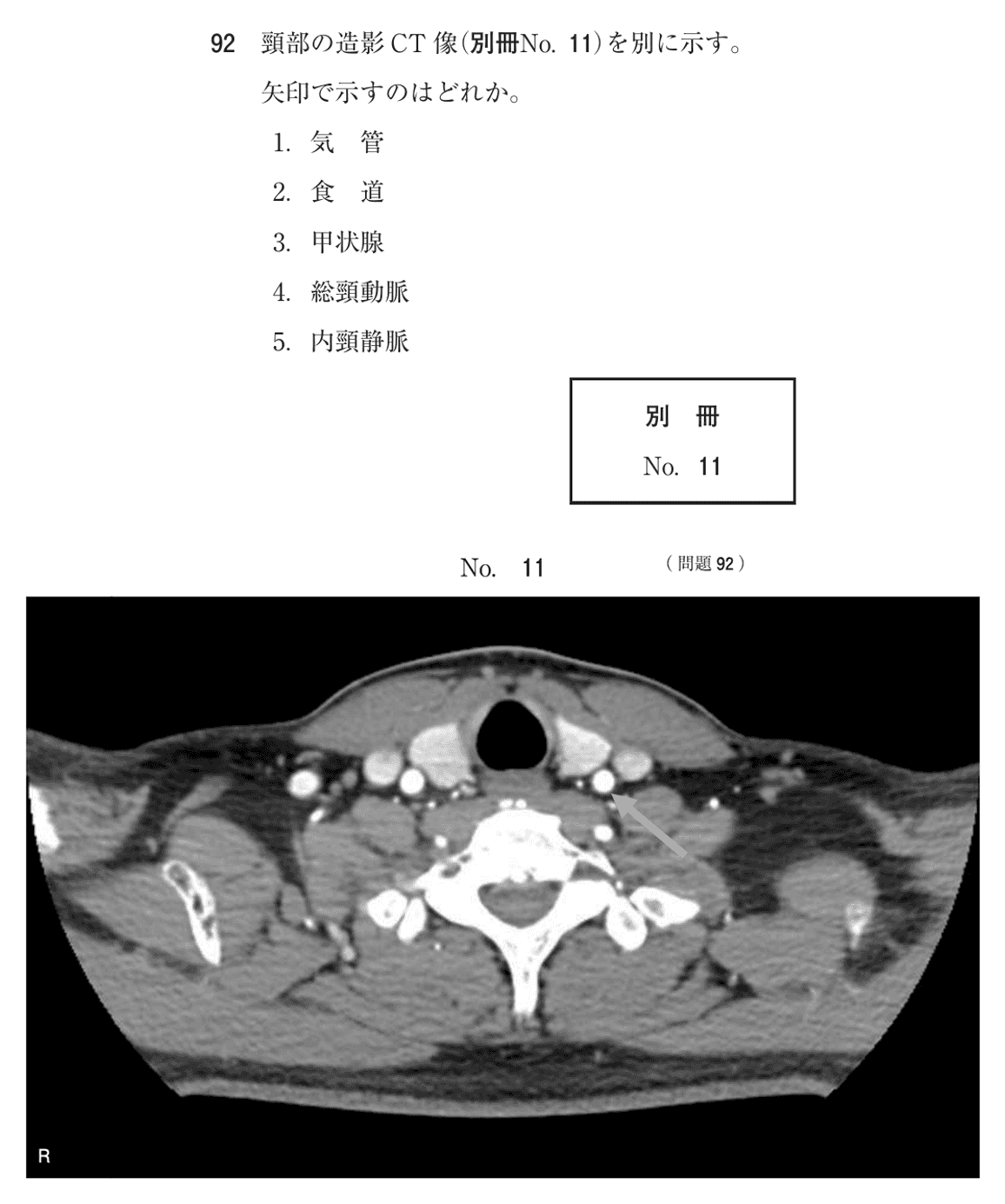 第77回 午前 問92の紙面