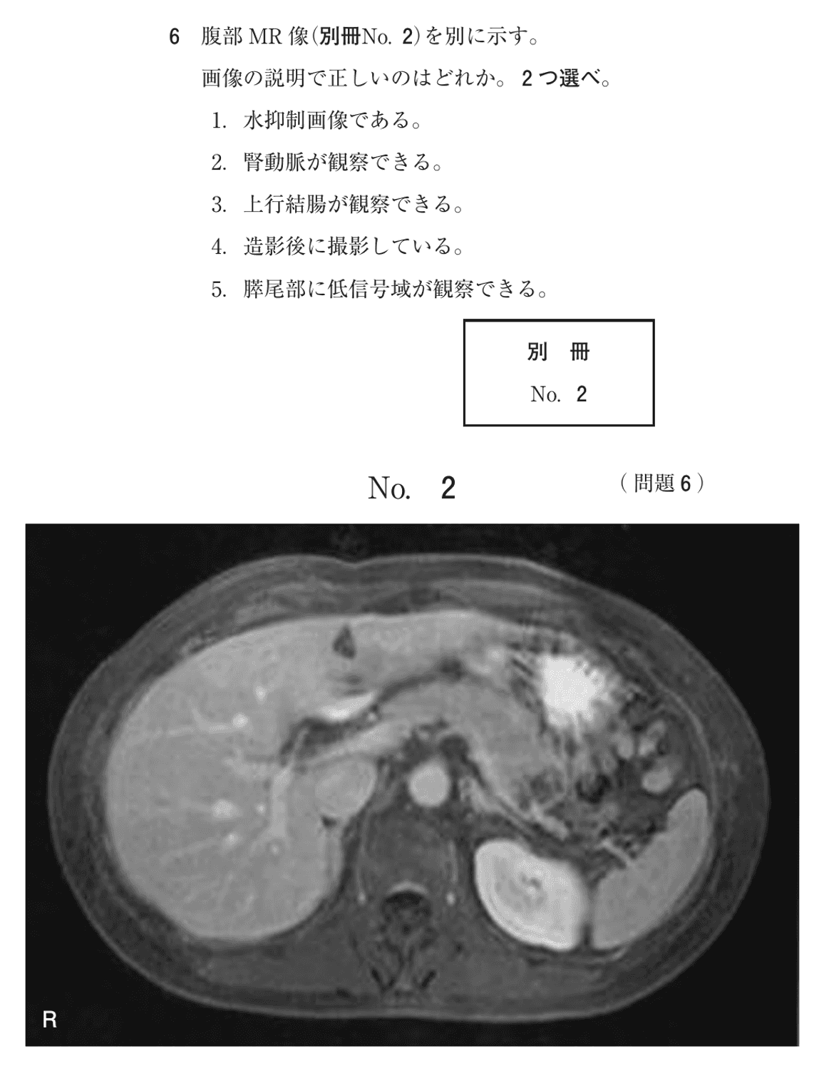 第78回 午前 問6の紙面