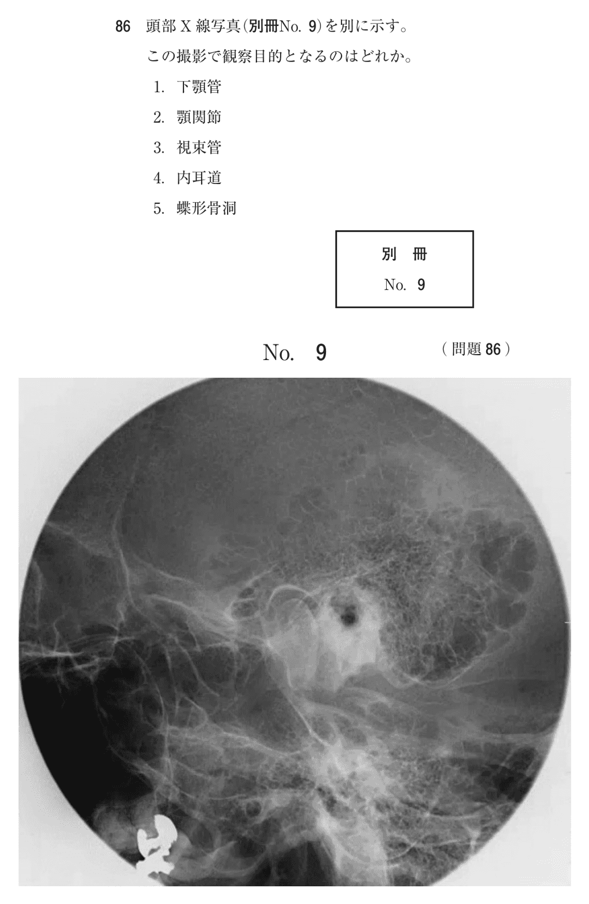 第72回 午前 問86の紙面