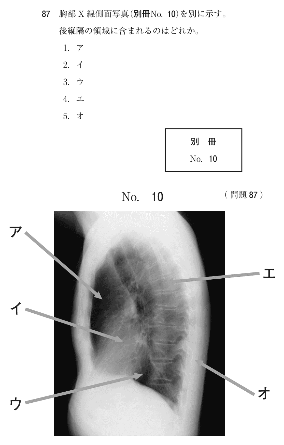 第72回 午前 問87の紙面