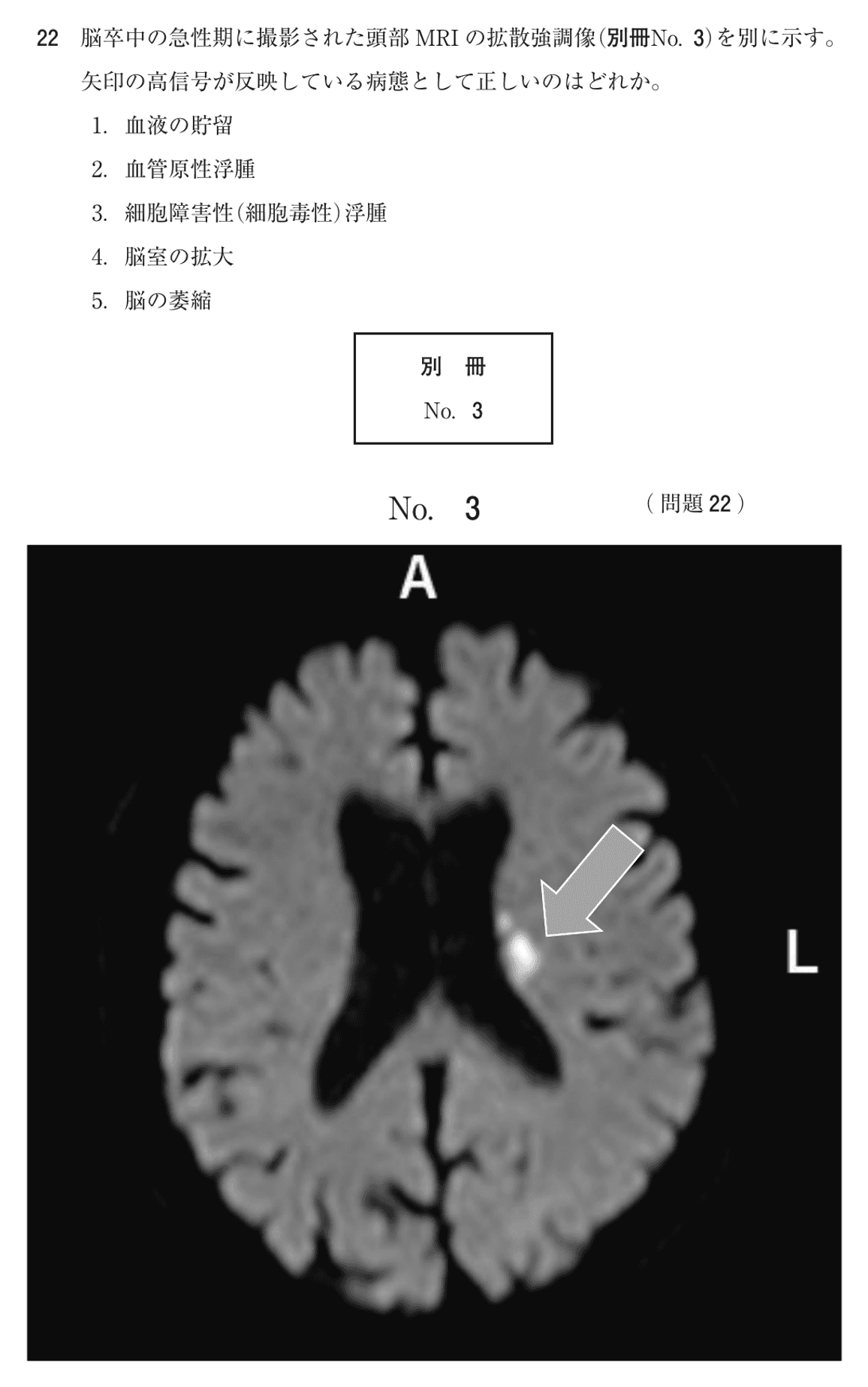 第72回 午後 問22の紙面