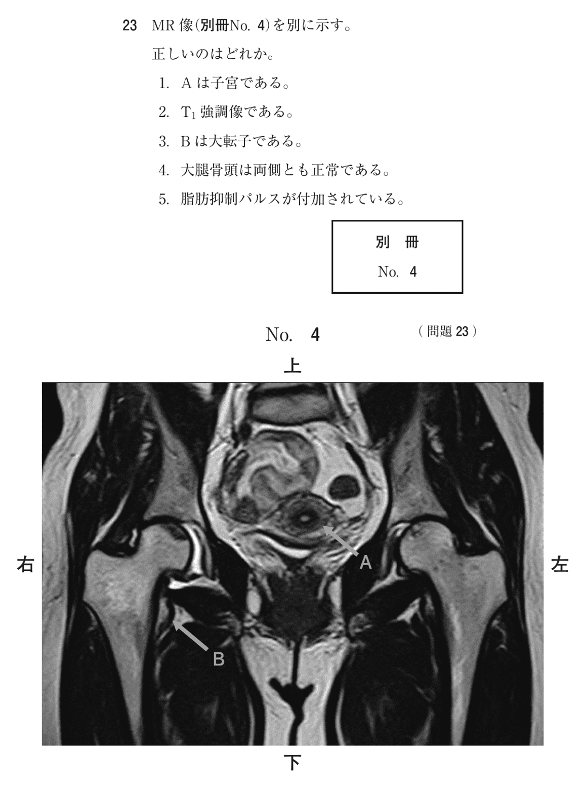 第72回 午後 問23の紙面
