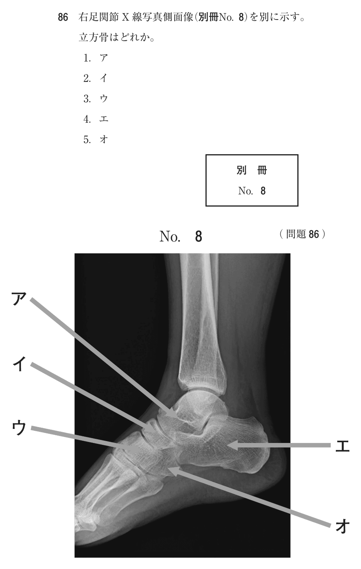 第72回 午後 問86の紙面