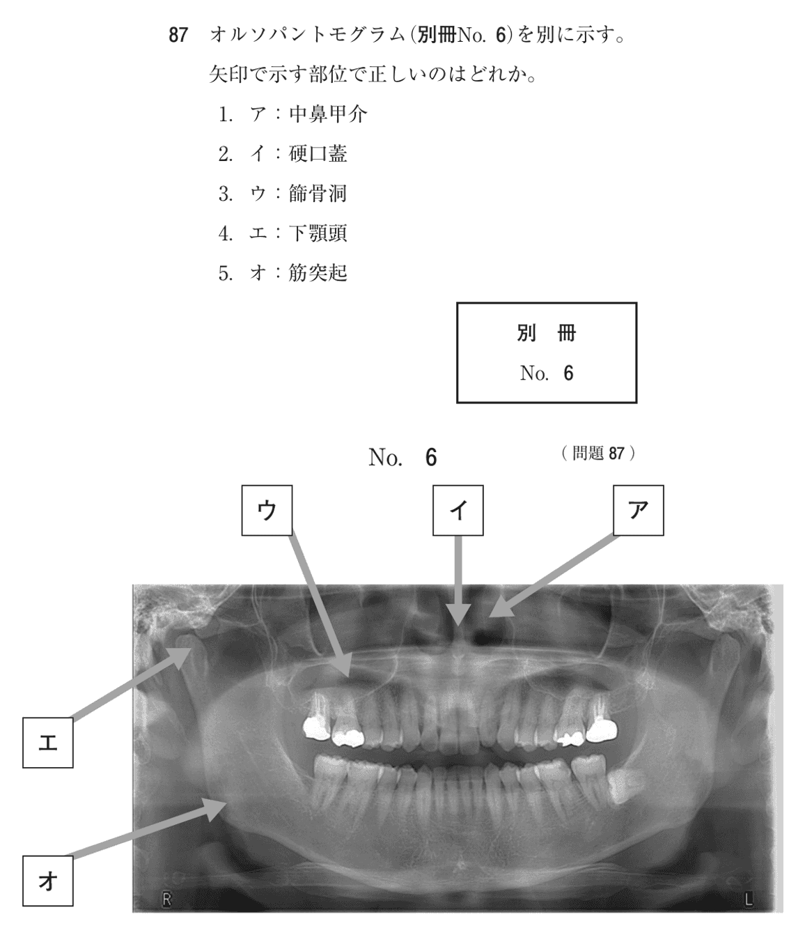 第73回 午前 問87の紙面